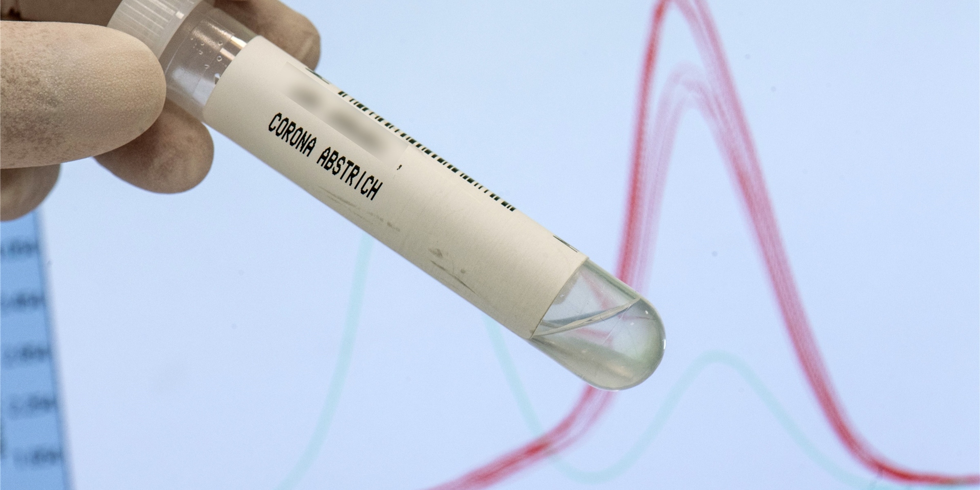 Wissenschaftler haben eine neue Mutation des Coronavirus entdeckt. Erste Fälle wurden auch schon in Europa registriert.
