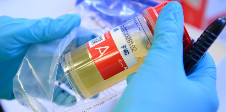 Die Urinprobe wäre positiv: Ein in Deutschland verbotener Stoff wird in Nahrungsergänzungsmitteln zur Leistungssteigerung verwendet und fällt unter die Dopingregularien.