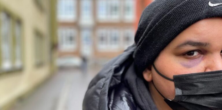 Eine junge Frau mit einem blauen Auge und Mundschutz in der Nonnenstiege in Dorsten.