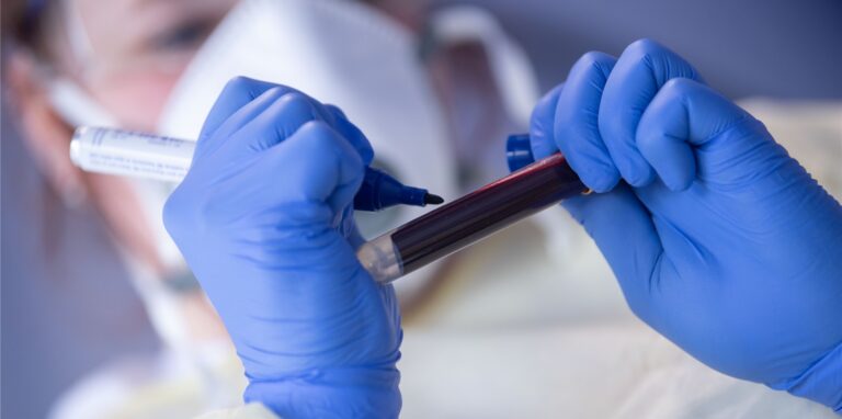 Die Blutgruppe hat nach wissenschaftlichen Erkenntnissen einen gewissen Einfluss auf das individuelle Corona-Infektionsrisiko.