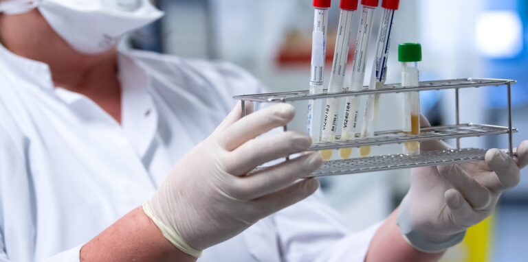 PCR Tests werden in der Regel im Labor durchgeführt.