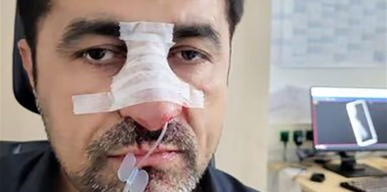 Der verletzte SPD-Stadtrat Halil Tasdelen.