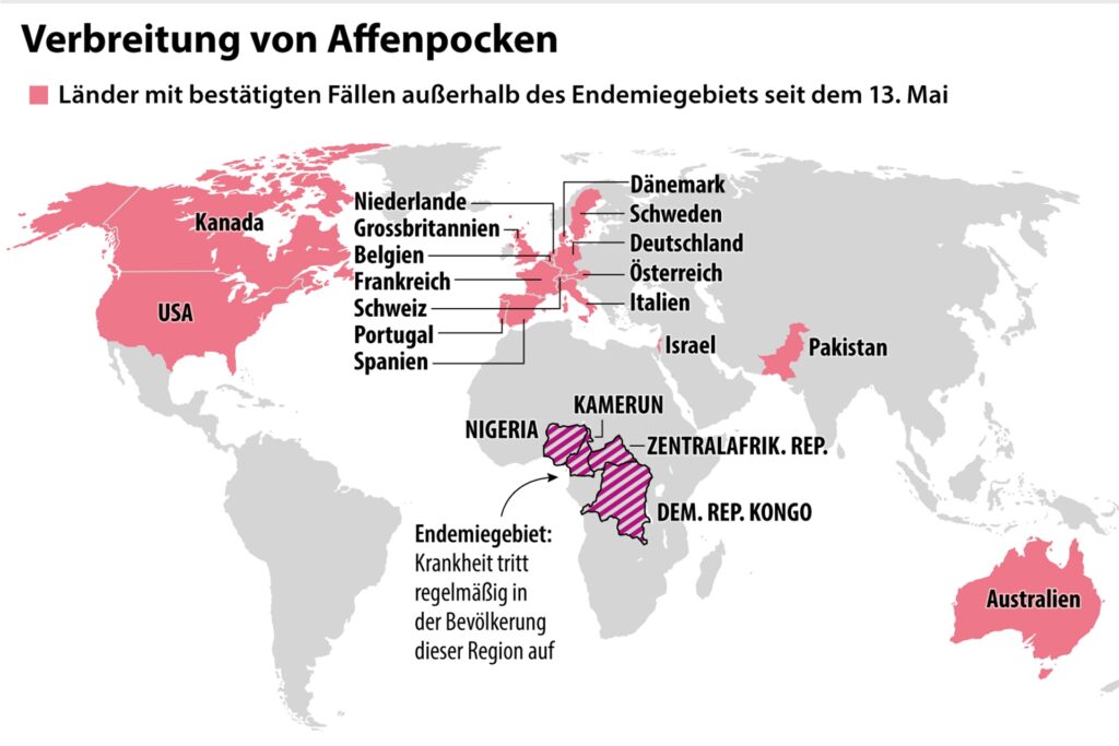 Weltkarte mit bislang bestätigten Fällen von Affenpocken