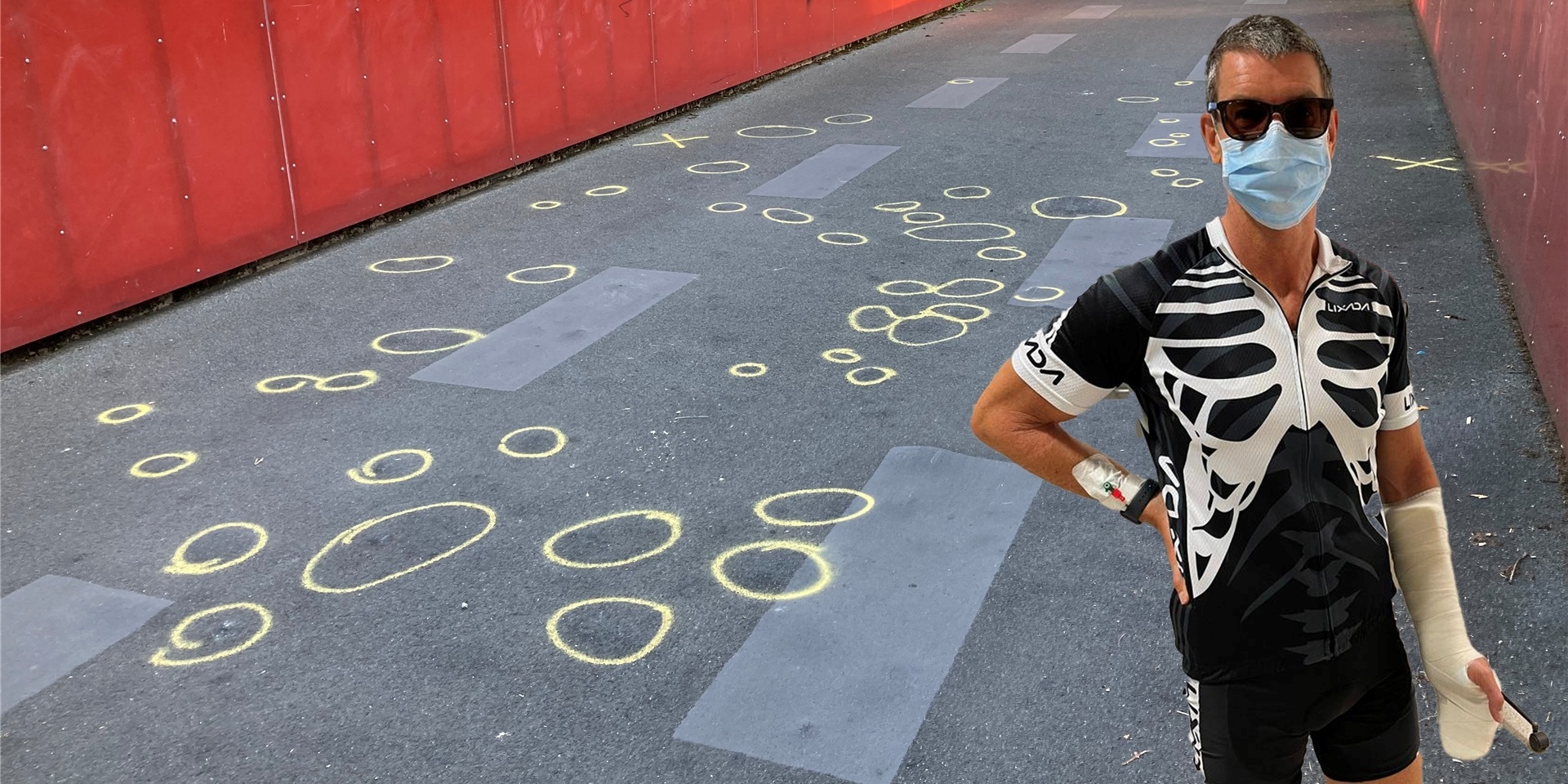 Die Montage zeigt Oliver Steiner aus Recklinghausen im Radler-Outfit und mit Gipsarm vor einer Brücke über den Radweg Allee des Wandels. Auf der Brücke sind Blasen im Asphalt mit gelber Farbe markiert worden.