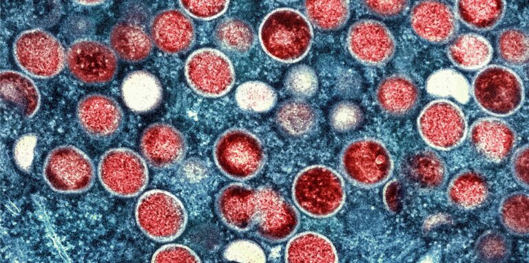Eine kolorierte transmissionselektronenmikroskopische Aufnahme von Partikeln des Affenpockenvirus (rot) in einer infizierten Zelle (blau), die im Labor gezüchtet und in der NIAID Integrated Research Facility aufgenommen wurde, veröffentlicht am 26. Juli 2022 in Fort Detrick, Maryland.