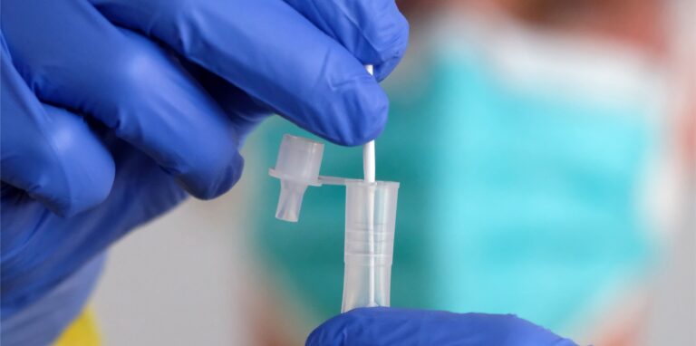 Ein medizinischer Mitarbeiter hält eine Coronatest-Probe in der Hand.