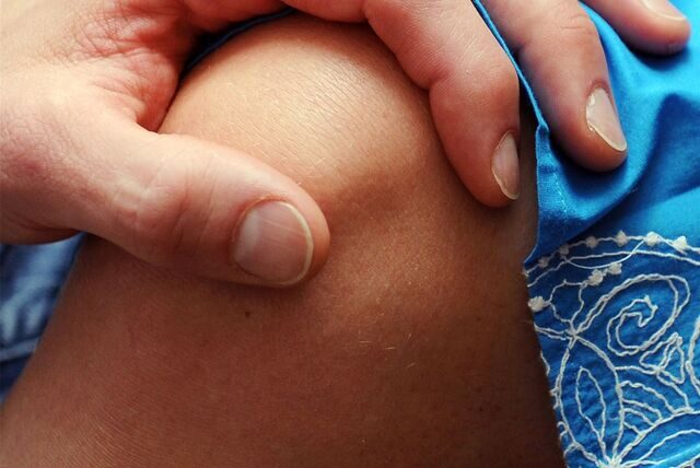 Eine Männerhand berührt ein unter einem blauen Kleid freiliegendes Knie. (Symbolbild)