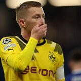 Marco Reus fasst sich ins Gesicht.