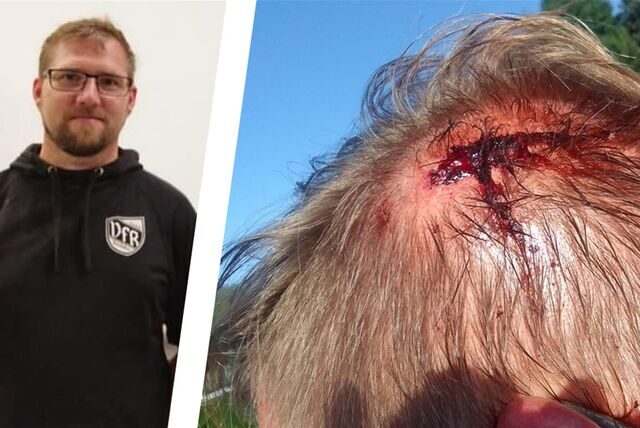 André Hoff trug am Samstag bei einem Dortmunder E-Junioren-Fußballspiel einige Verletzungen davon. Der gegnerische Trainer prügelte auf ihn ein.