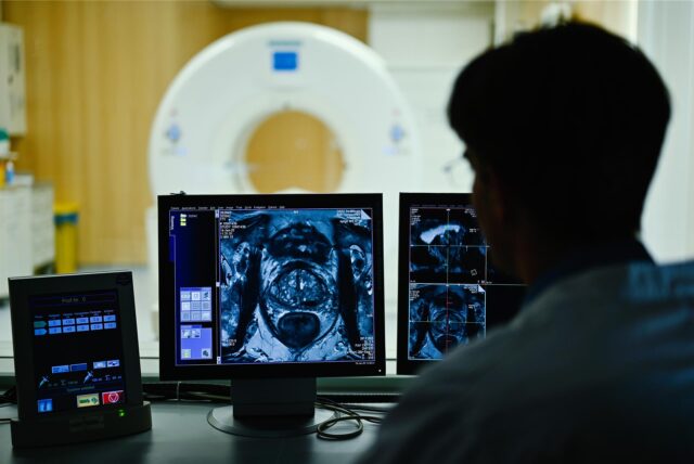 Ein Mitarbeiter betrachtet in einem Kontrollraum des Deutschen Krebsforschungszentrum (DKFZ) auf einem Monitor das Querschnittsbild einer Prostata.