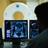 Ein Mitarbeiter betrachtet in einem Kontrollraum des Deutschen Krebsforschungszentrum (DKFZ) auf einem Monitor das Querschnittsbild einer Prostata.