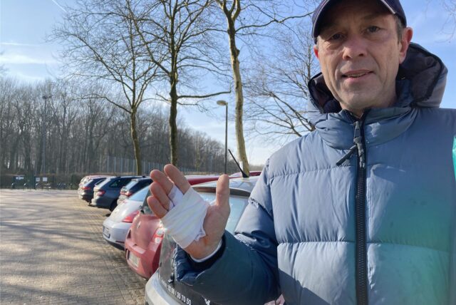 Volker Schulte im Walde aus Bottrop steht mit einer verbundenen rechten Hand auf dem Parkplatz an der Kuhstraße in Herten-Westerholt.